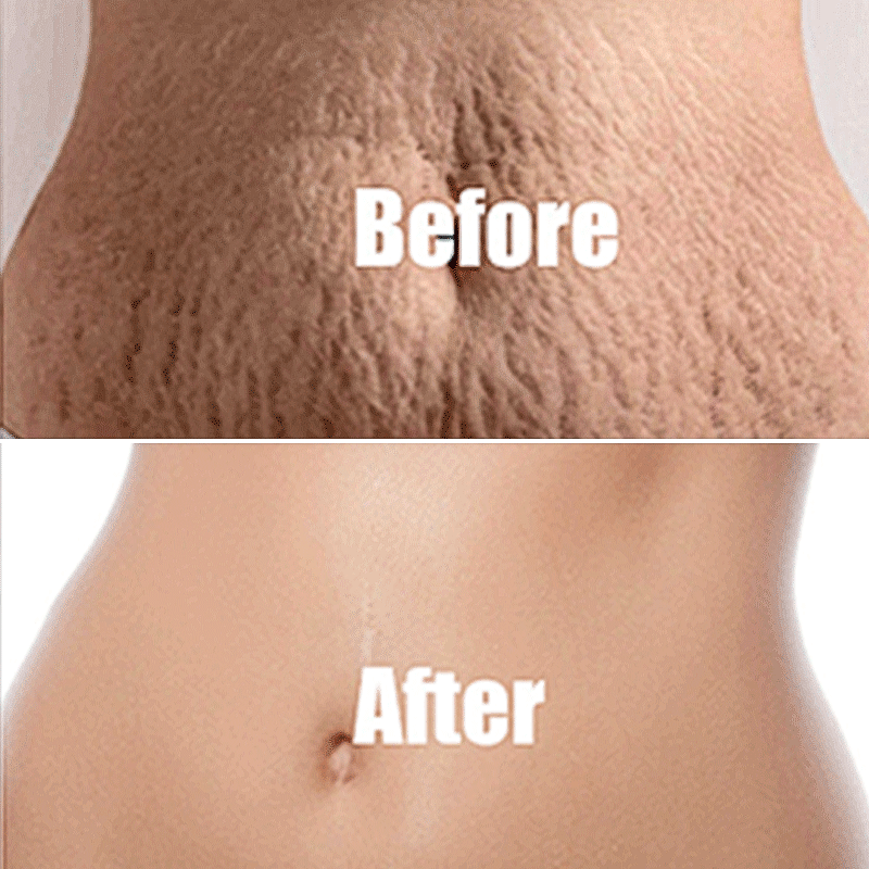 B-FLAT Belly Firming Cream